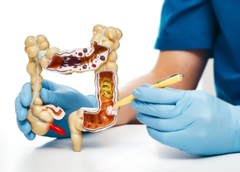 Bahia pode registrar mais de 2 mil novos casos de câncer colorretal em 2026, estima instituto